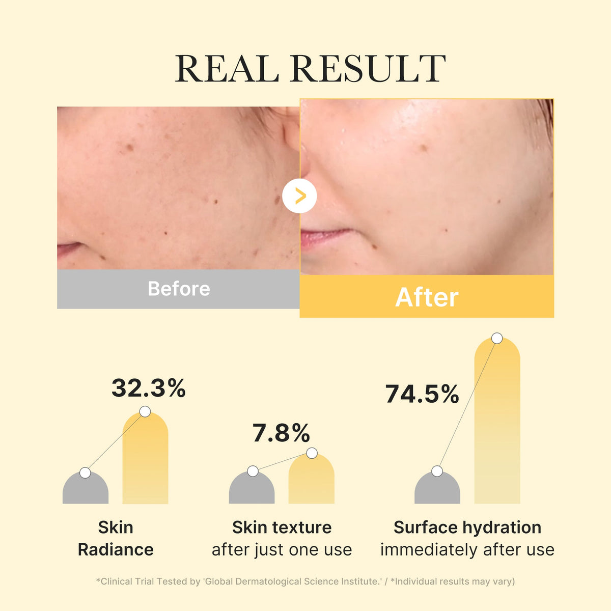Résultats cliniques du masque Medicube Acide Kojique et Curcuma