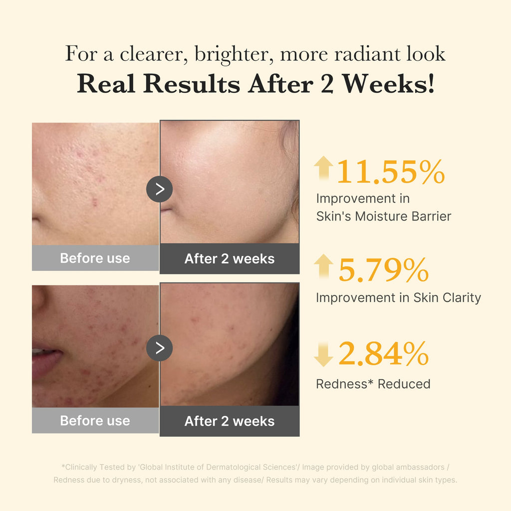 Résultats cliniques du Medicube Kojic Acid Turmeric Capsule Serum