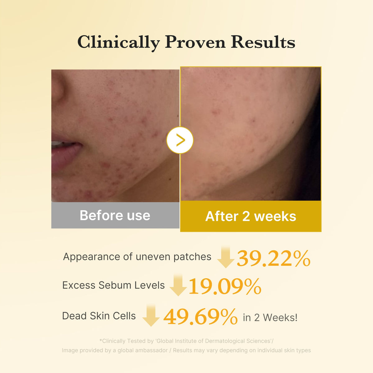 Medicube Kojic Acid Turmeric Toner Pad – résultats cliniques