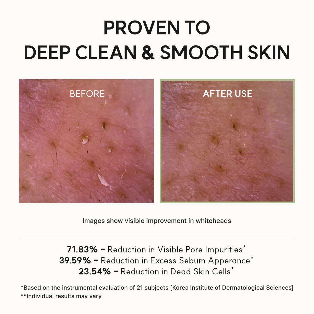 Résultats cliniques Arencia Fresh Green sur pores, sébum et cellules mortes