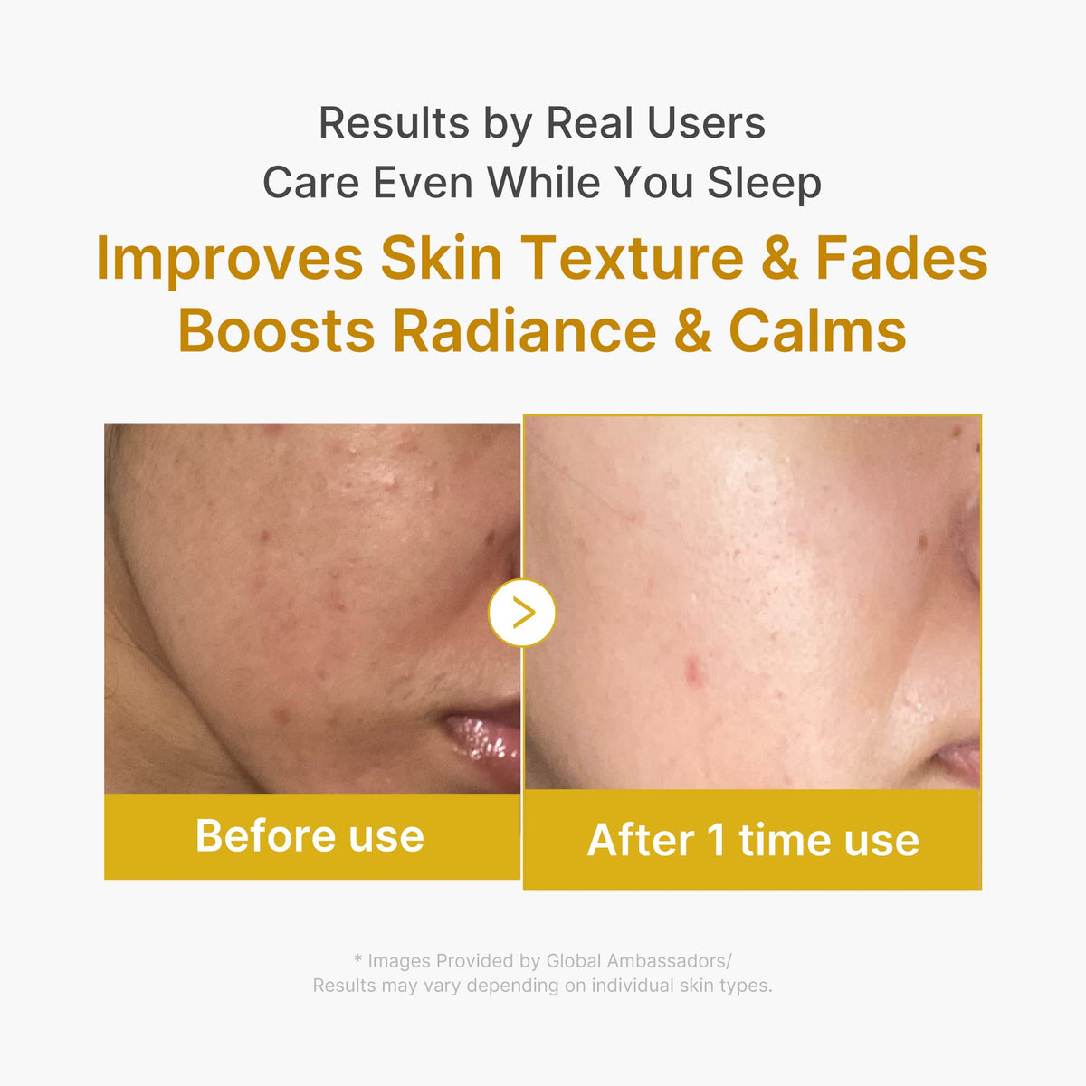 Résultats du masque Medicube sur la texture et l’éclat de la peau