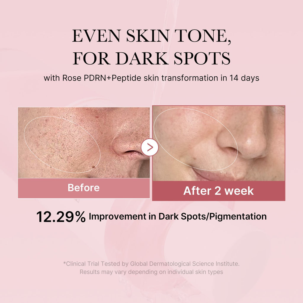 Résultats sur le teint et les taches – Medicube PDRN Pink Peptide Toner