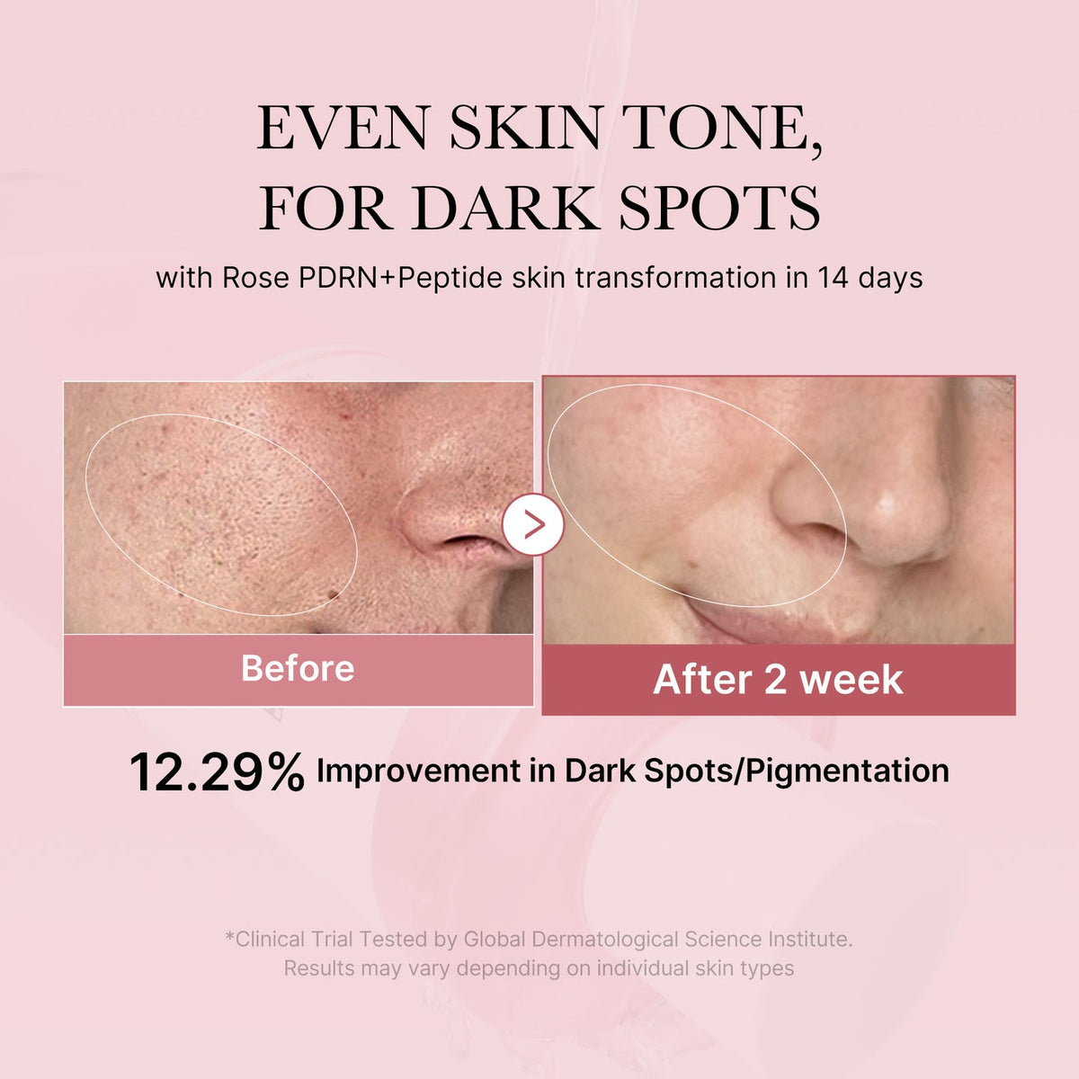 Résultats sur le teint et les taches – Medicube PDRN Pink Peptide Toner