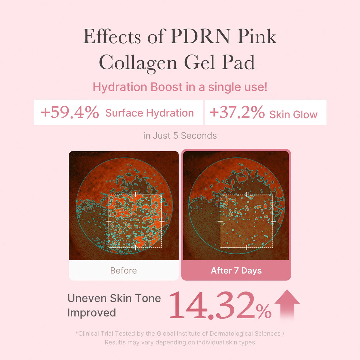 Résultats Medicube PDRN Pink Collagen Gel Toner Pad sur hydratation et éclat