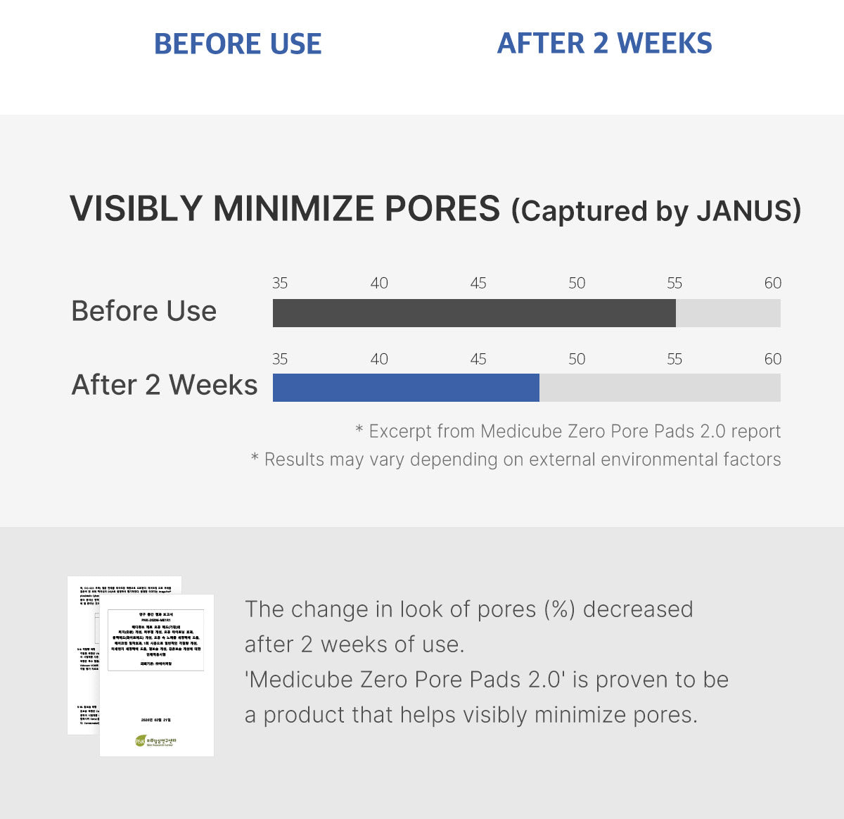 Medicube Zero Pore Pad 2.0 – résultats sur l’apparence des pores après deux semaines